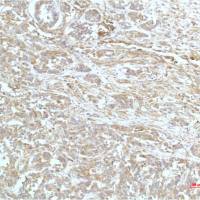 alpha Actinin (1A5) Mouse mAb