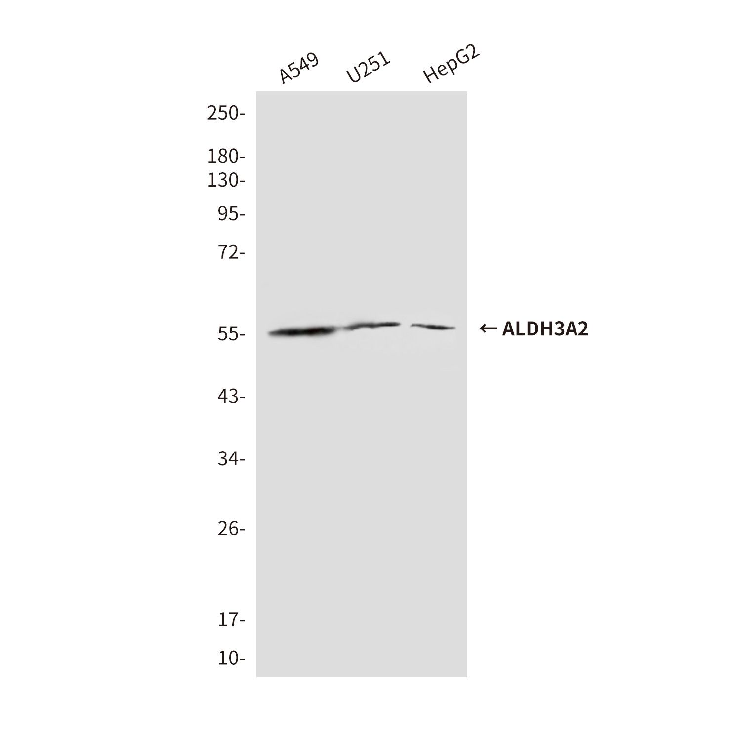 ALDH3A2 (3F7) Mouse mAb