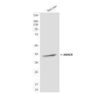 AMACR (2F3) Mouse mAb