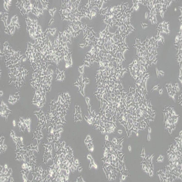 HSF(SV40转染)细胞(科研实验专用培养基)