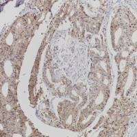 AMACR Recombinant Rabbit mAb