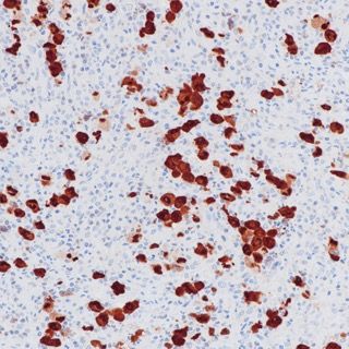 ALK Recombinant Rabbit mAb