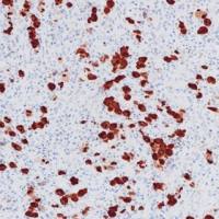 ALK Recombinant Rabbit mAb