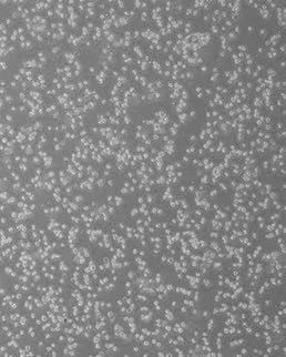 TF-1细胞中为什么要加刺激因子GM-CSF？