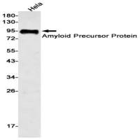 Amyloid Precursor Protein (DGR16504) Rabbit mAb