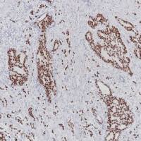 Androgen Receptor Recombinant Rabbit mAb