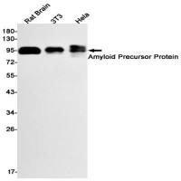 Amyloid Precursor Protein (DGR16504) Rabbit mAb