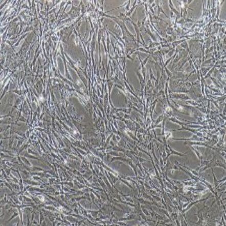 人原代胎盘微血管内皮细胞