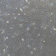 人原代羊膜间充质干细胞