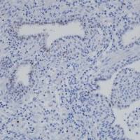 AR-V7 Recombinant Rabbit mAb