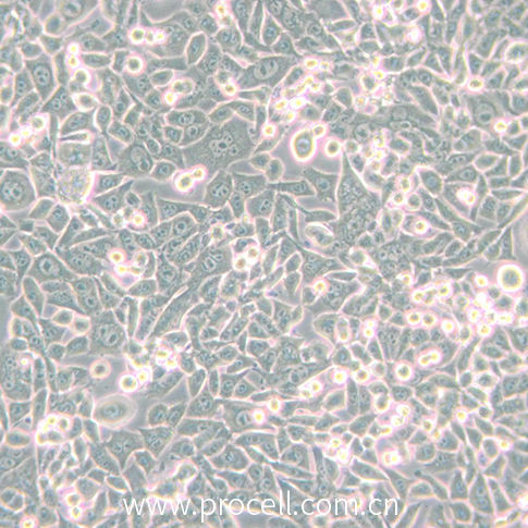 细胞学堂 | 4T1(小鼠乳腺癌细胞)特性和收货、培养注意事项