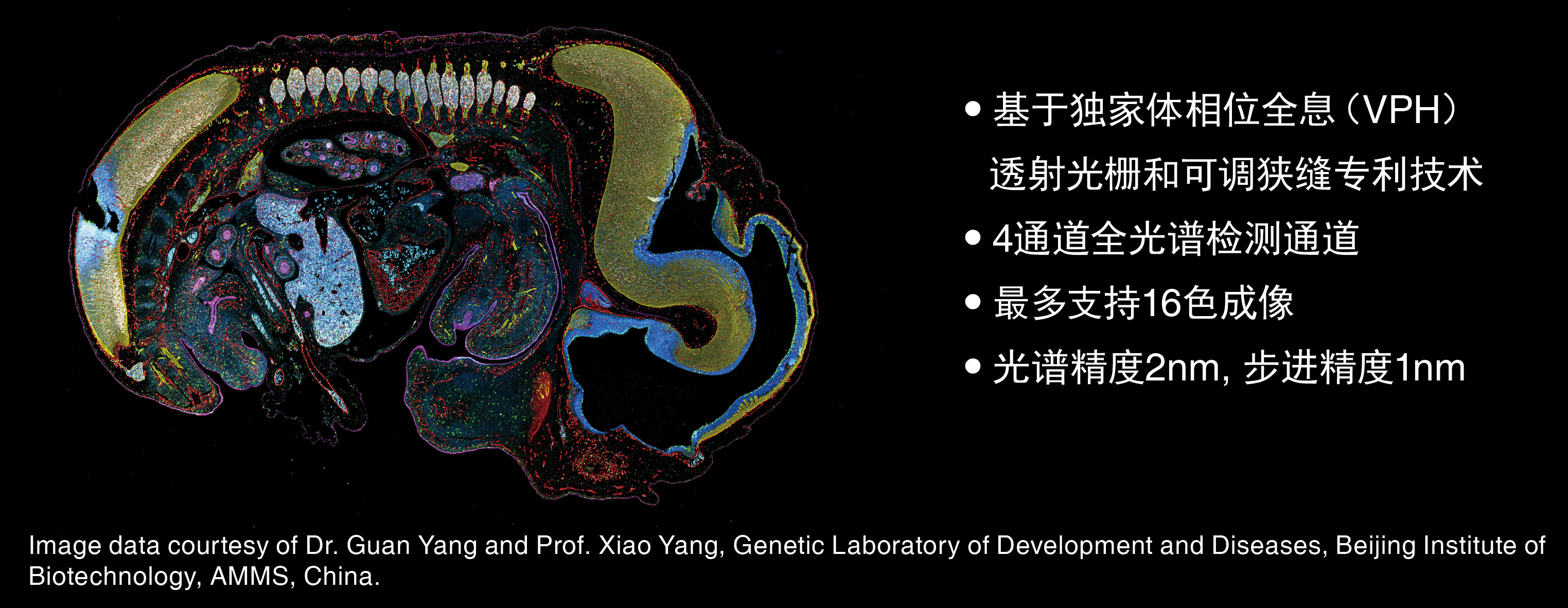 科技前沿丨FV3000助力揭示光感知调控血糖代谢的神经机制