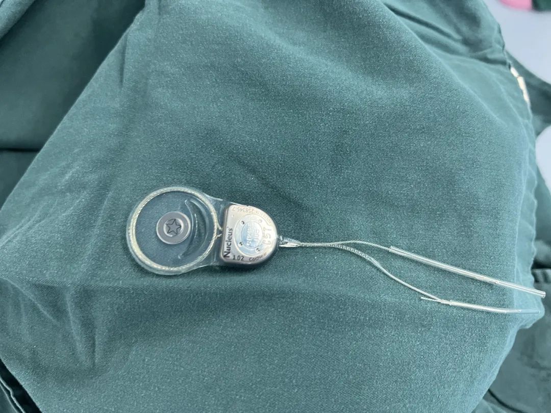 耳聋老人重获新「声」，浙大四院开展首例人工耳蜗植入术！