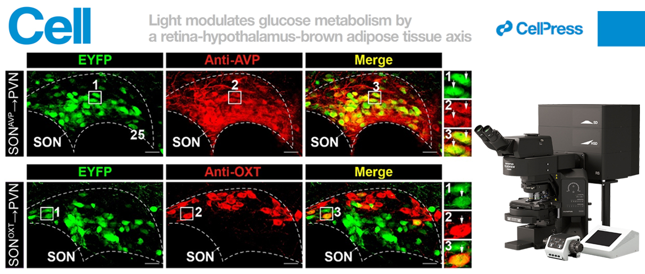 科技前沿丨FV3000助力揭示光感知调控血糖代谢的神经机制