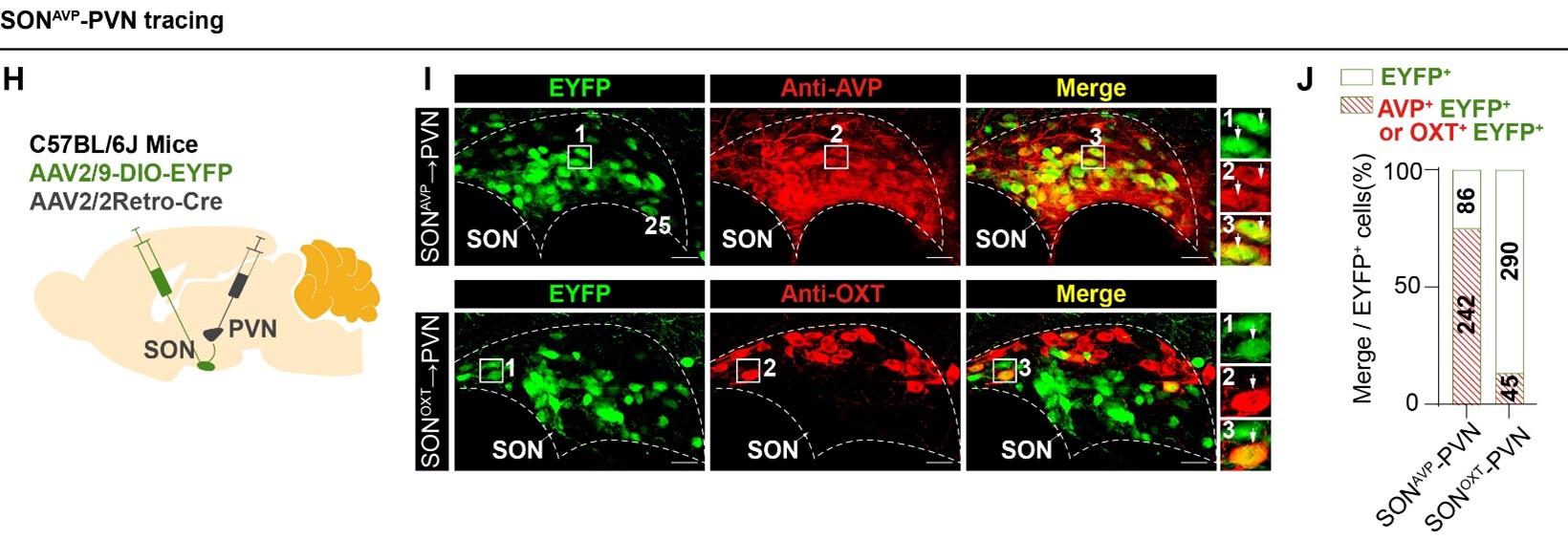 科技前沿丨FV3000助力揭示光感知调控血糖代谢的神经机制
