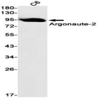 Argonaute-2 (DGR12085) Rabbit mAb