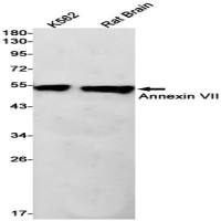 Annexin VII (DGR11155) Rabbit mAb