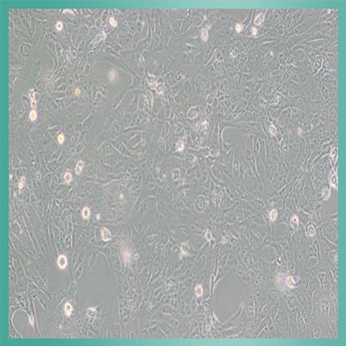 EL4细胞_小鼠淋巴瘤细胞