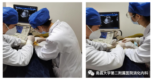 南昌大学第二附属医院成功救治一位疑难重症肝病患者