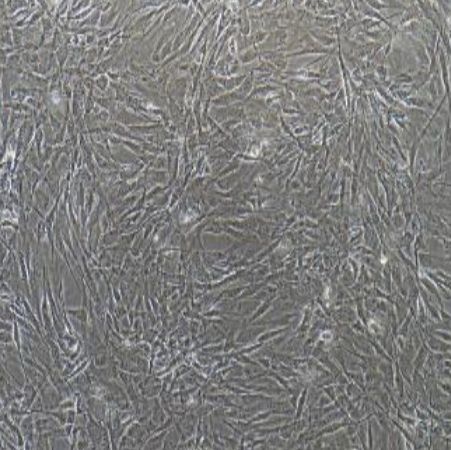 人原代肝成纤维细胞