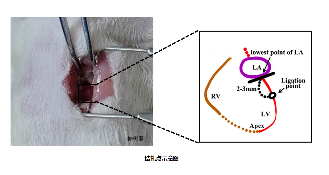心肌缺血再灌注损伤与心肌细胞