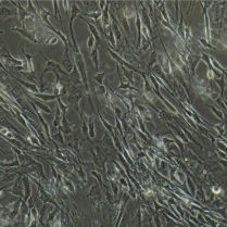 人原代胰岛β细胞