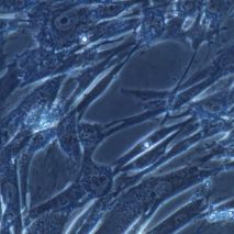 人原代肾上腺包膜成纤维细胞