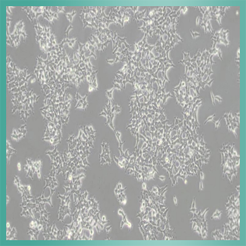 Y1细胞_小鼠肾上腺皮质瘤细胞