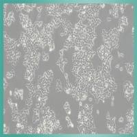 S-180细胞_小鼠腹水瘤细胞