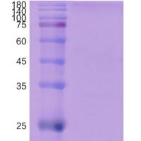 实时荧光定量PCR(RealTime PCR)技术服务