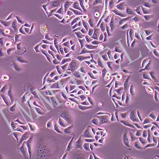 HELA-LUC人宫颈癌细胞丨荧光素酶标记