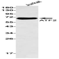 ATF2 (DGR21041) Rabbit mAb