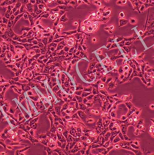 MB49-LUC小鼠膀胱癌细胞丨荧光素酶标记