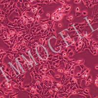 MB49-LUC小鼠膀胱癌细胞丨荧光素酶标记