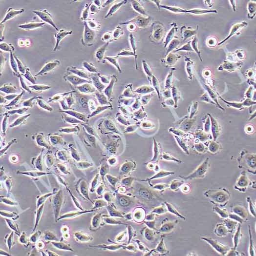SIHA-LUC人子宫颈鳞癌细胞丨荧光素酶标记