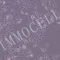 HCT8-LUC人回盲肠癌细胞丨荧光素酶标记