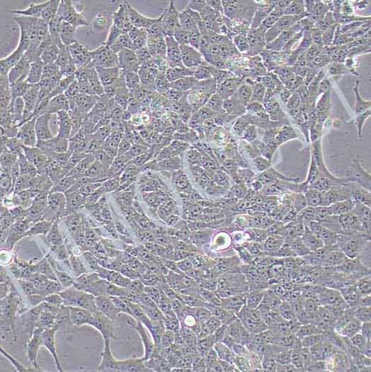 T47D-LUC人乳腺癌细胞丨荧光素酶标记