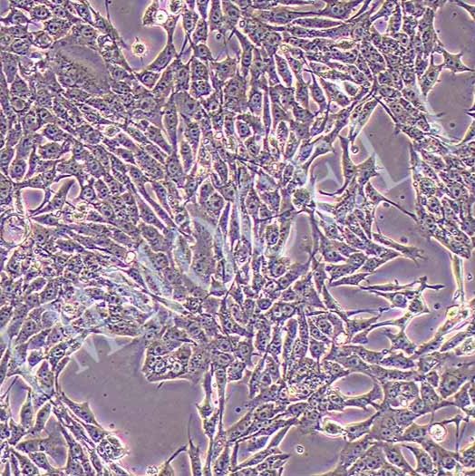 4T1-LUC小鼠乳腺癌细胞丨荧光素酶标记