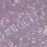 4T1-LUC小鼠乳腺癌细胞丨荧光素酶标记