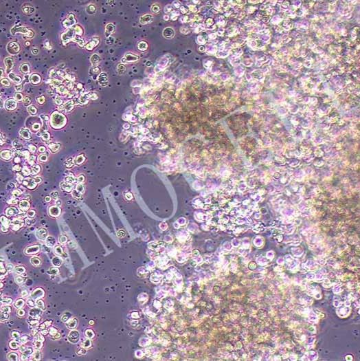 NK-92MI(人恶性非霍奇金淋巴瘤患者的自然杀伤细胞)(STR鉴定正确)