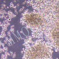 NK-92MI(人恶性非霍奇金淋巴瘤患者的自然杀伤细胞)(STR鉴定正确)