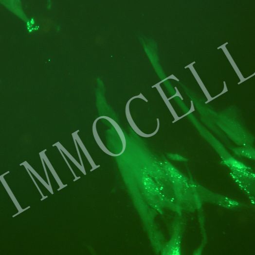 MSC-EGFP-LUC人脐带间充质干细胞丨绿色荧光蛋白-荧光素酶标记
