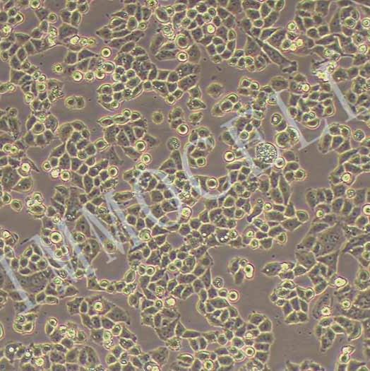 NCI-H1703-LUC人肺鳞癌细胞丨荧光素酶标记