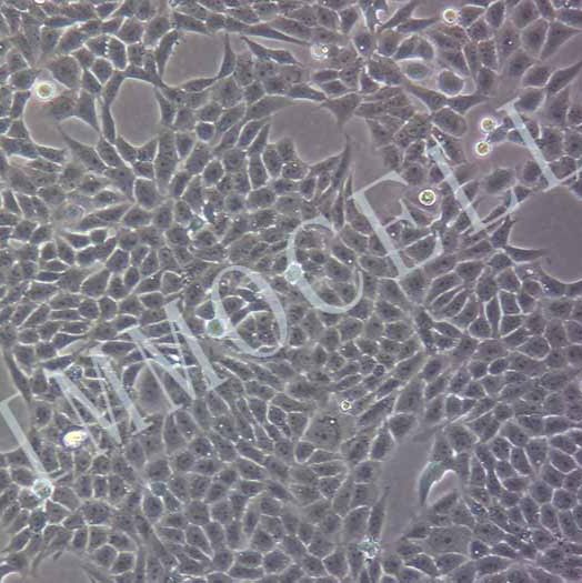 HGC27-LUC人胃癌细胞丨荧光素酶标记