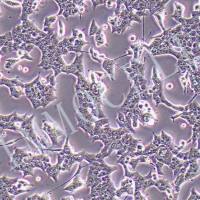 U87-MG-RFP人脑星形胶质母细胞瘤丨红色荧光蛋白标记