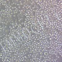 HBL-1-LUC人弥漫大B淋巴瘤细胞丨荧光素酶标记