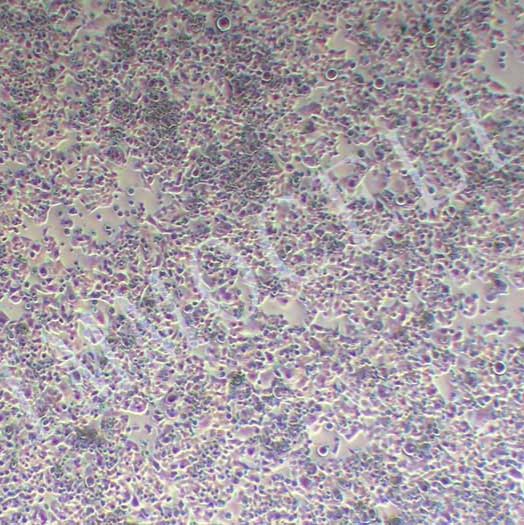 NCI-H520人肺鳞癌细胞丨NCI-H520细胞