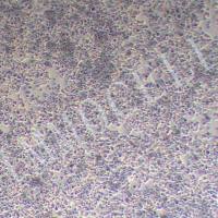 NCI-H520人肺鳞癌细胞丨NCI-H520细胞