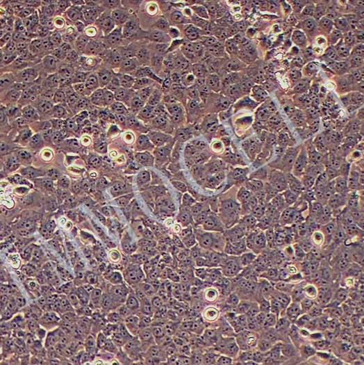 Nthy-ori3-1人甲状腺正常细胞丨逸漠(immocell)
