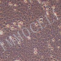 Nthy-ori3-1人甲状腺正常细胞丨逸漠(immocell)